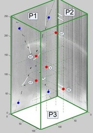 Obr. 12 3D zobrazen vypotenho modelu rozmstn objekt v biologick struktue, pohled P1 a P3